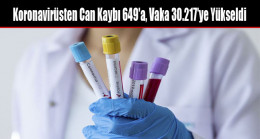 Koronavirüsten Can Kaybı 649’a, Vaka 30.217’ye Yükseldi
